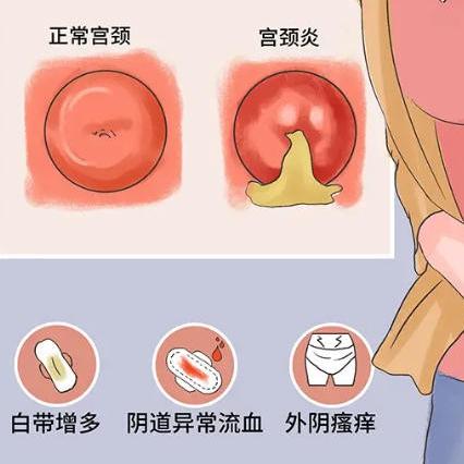了解女性阴道炎的症状表现，还得看泰安俪人医院的介绍