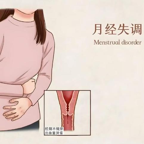 泰安俪人医院介绍月经不调的症状表现